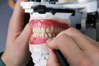 Best dental laboratory in california